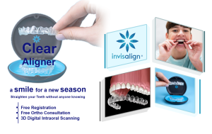 Clear aligners and invisible braces in Kabul Afghanistan - Hamdard Dental Clinic